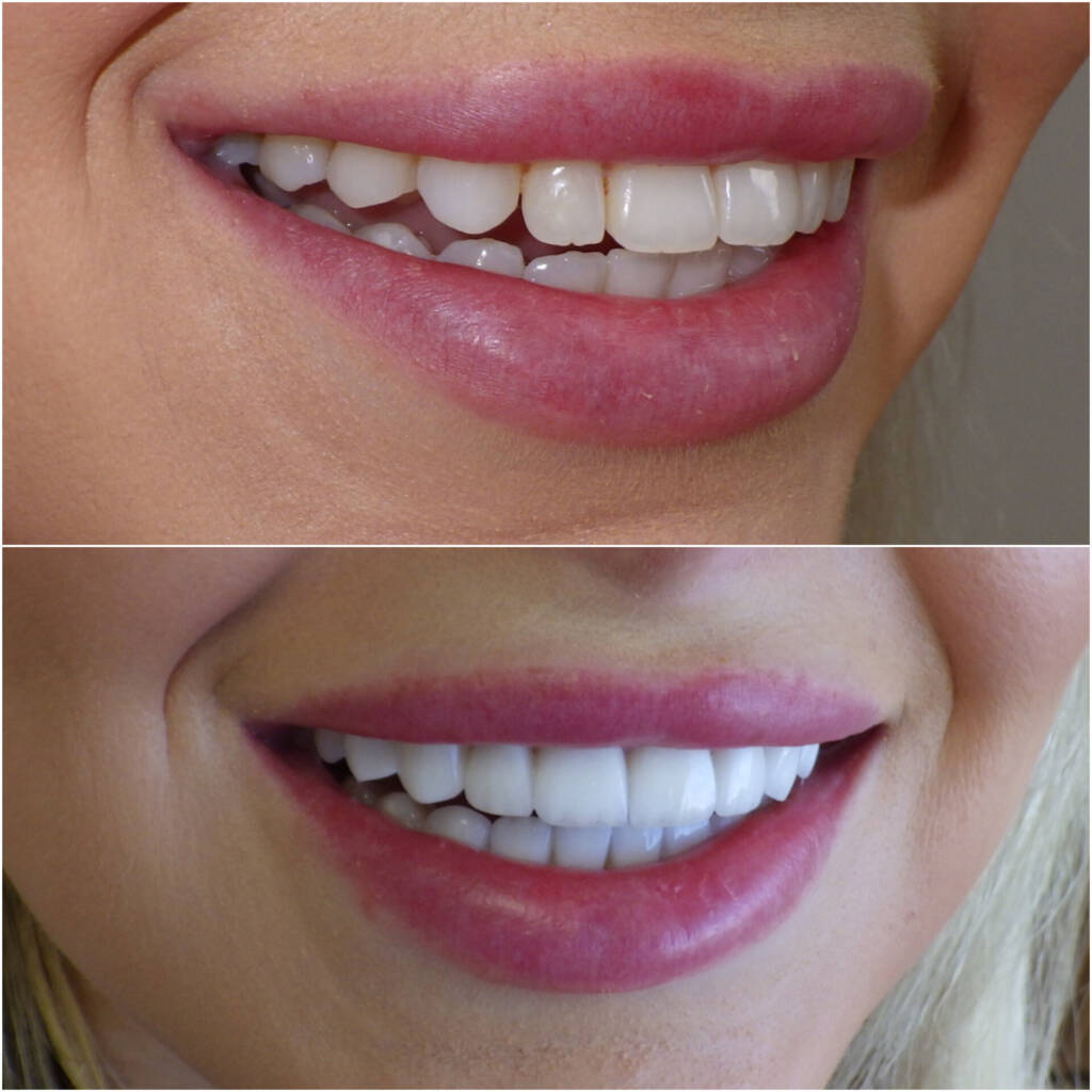 InShot 20251218 061248445