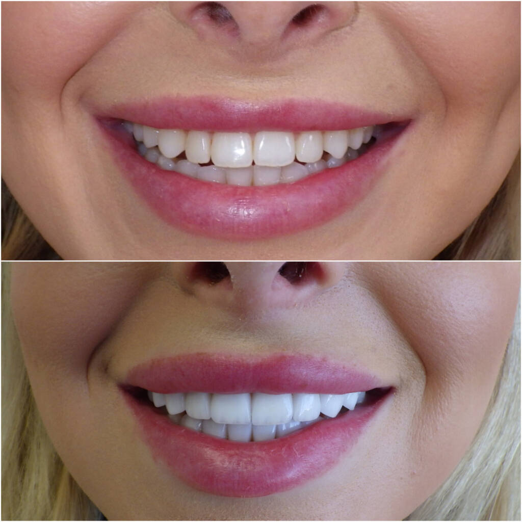 InShot 20251218 061457797