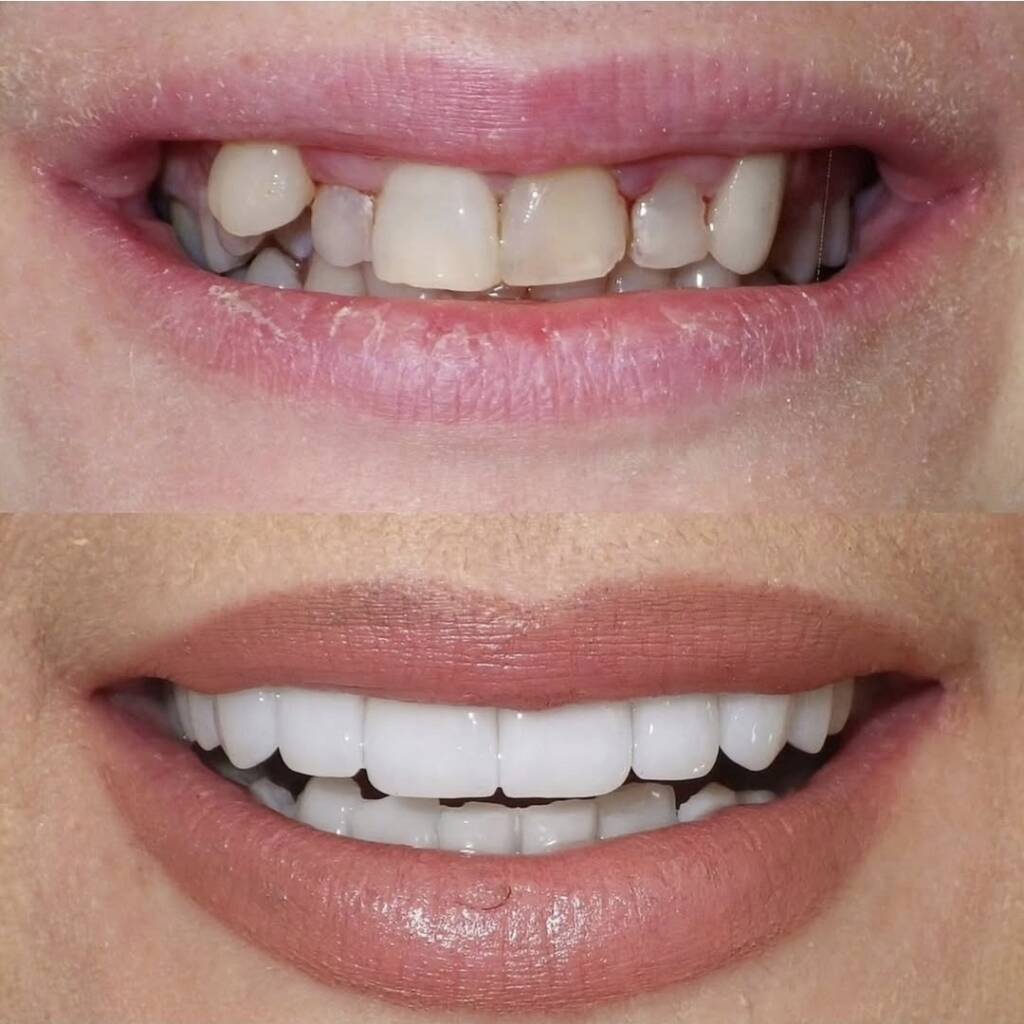 Screenshot 20251024 174340 Instagram