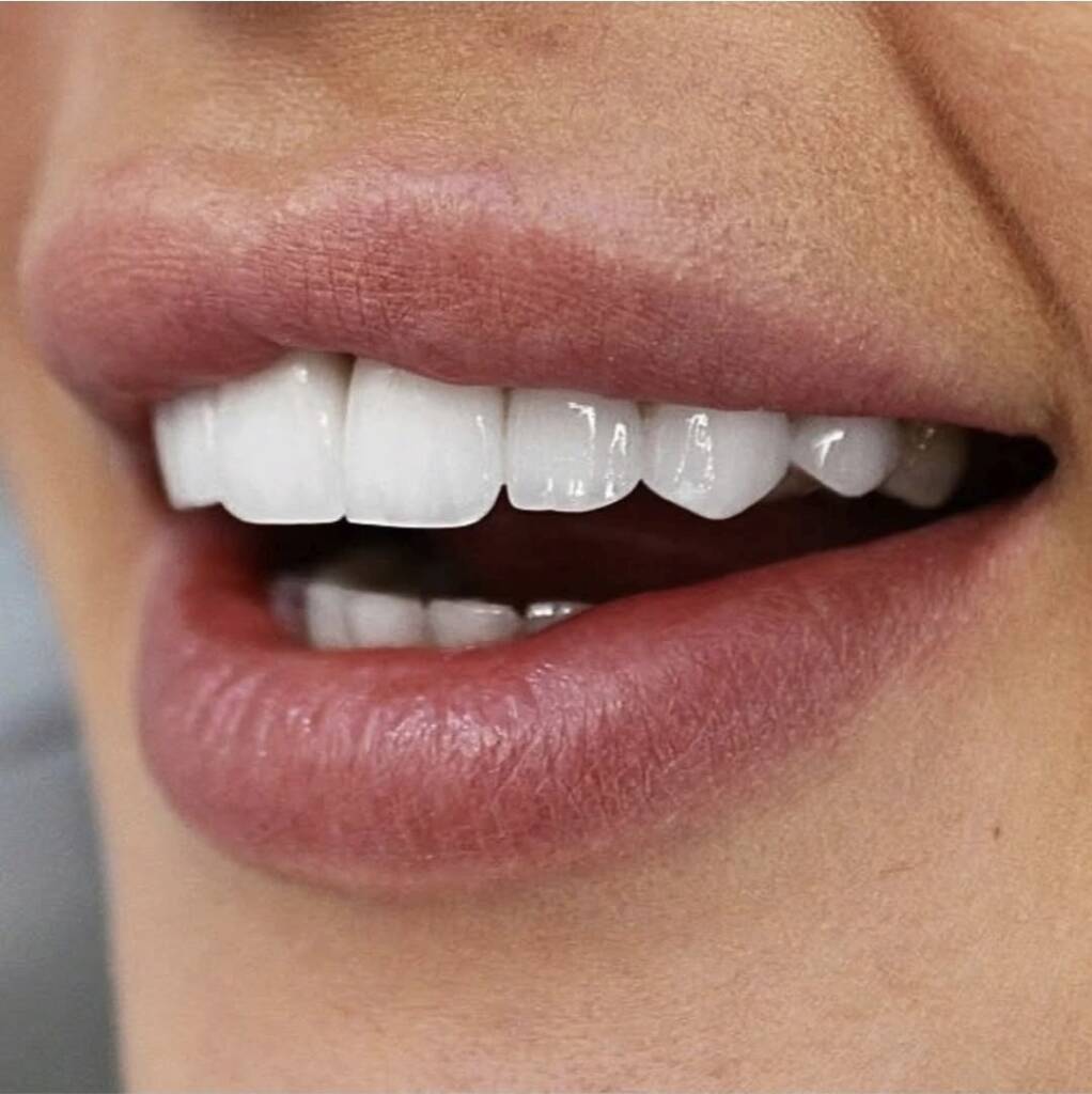 Screenshot 20251024 174700 Instagram