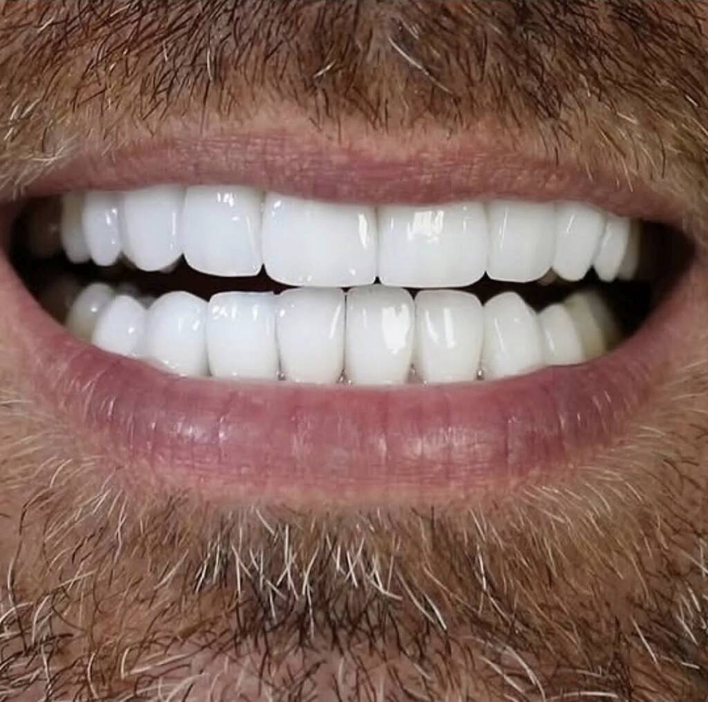 Screenshot 20251024 175014 Instagram