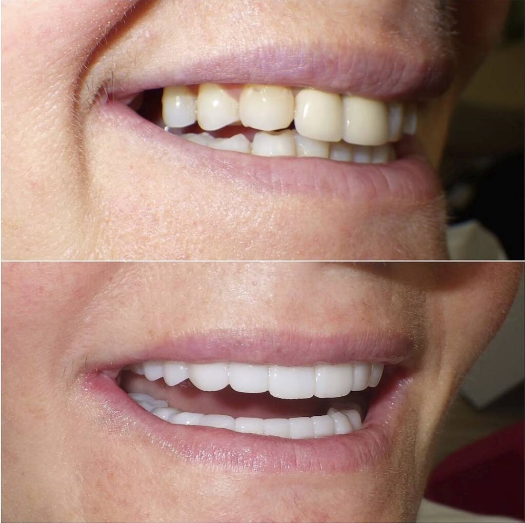 Screenshot 20251024 175711 Instagram