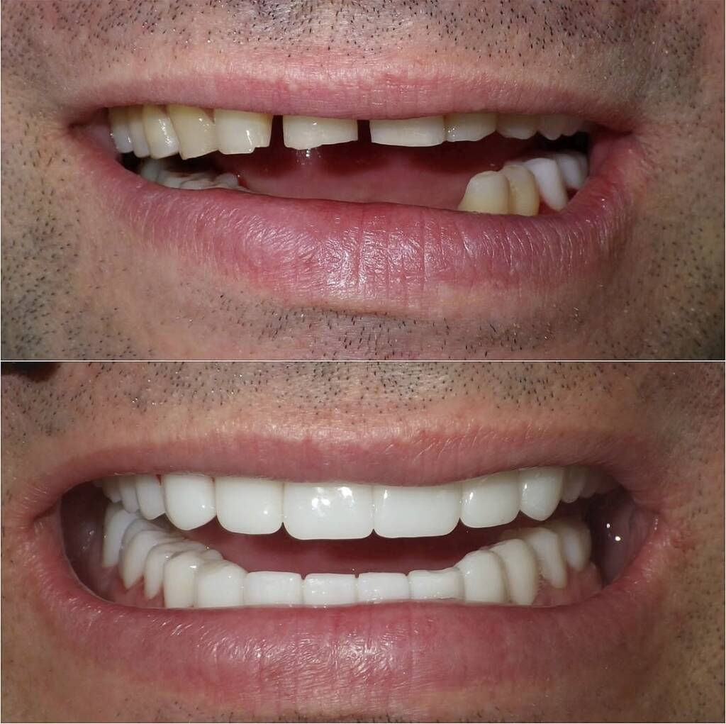 Screenshot 20251024 180612 Instagram