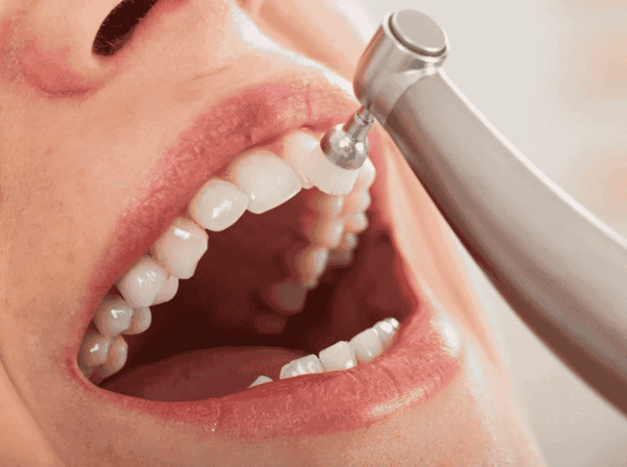 Teeth Cleaning - Fort Lauderdale Dental Aesthetic Center