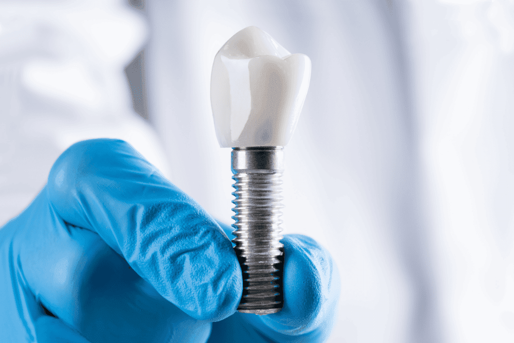 Dental Implants - Fort Lauderdale Dental Aesthetic Center