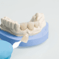 Zirconia Crowns