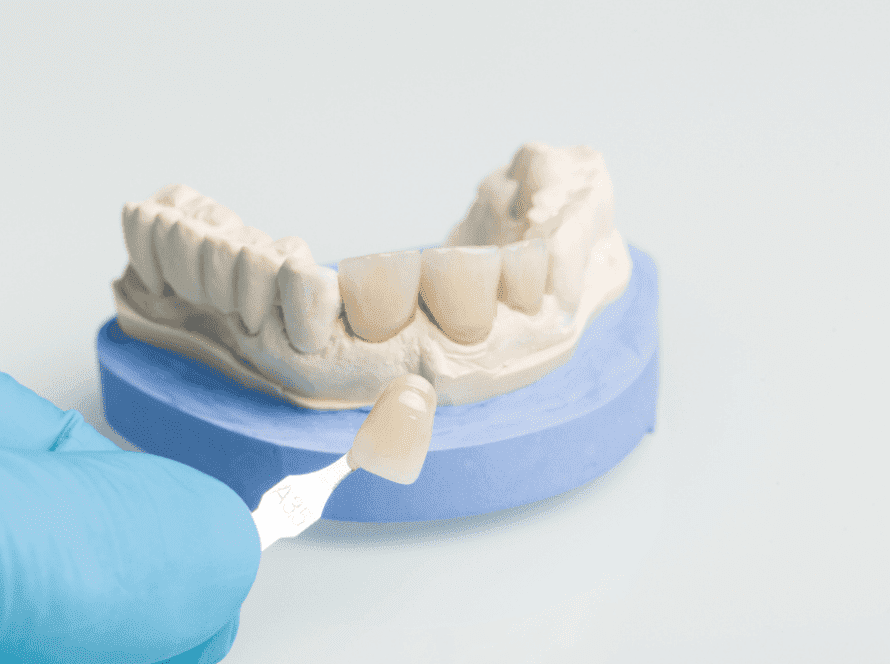 zirconia crowns - Fort Lauderdale Dental Aesthetic Center