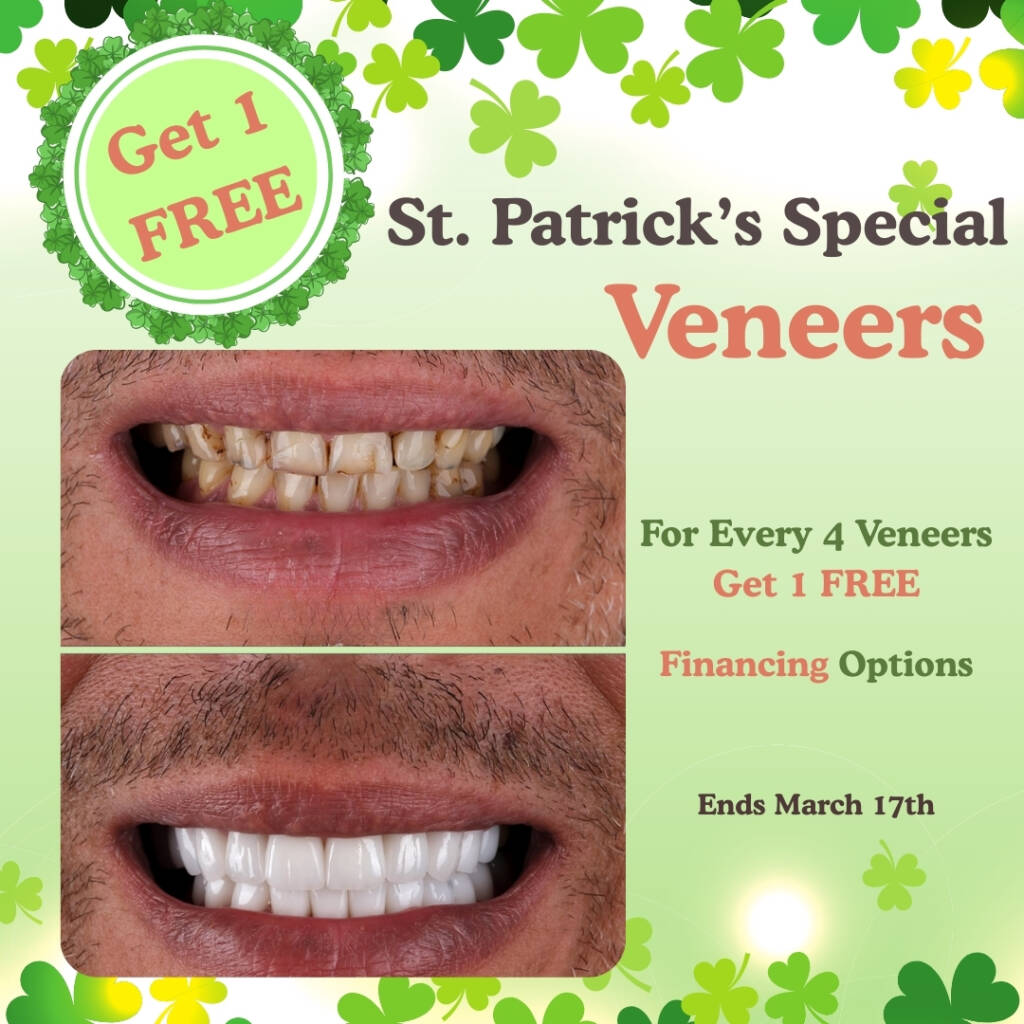 St. Patricks Day Special